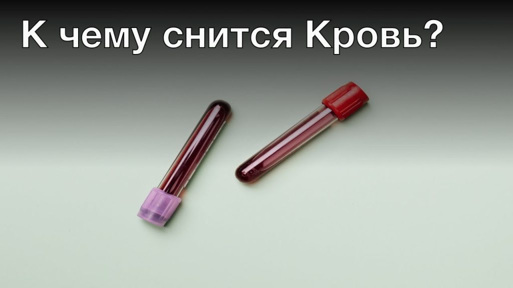 К Чему Снится Кровь: Толкование и Значение Во Снах